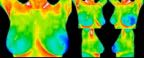1- A complete normal study of the breasts.jpg
