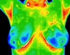 2- Normal thermal pattern.jp2