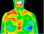 15- 1% of breast cancers are in men.jp2