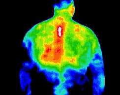 T4 Syndrome