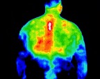 1- T4 Syndrome.jp2